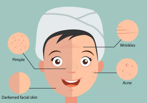 你知道嗎？「痣」的英語怎麼說？