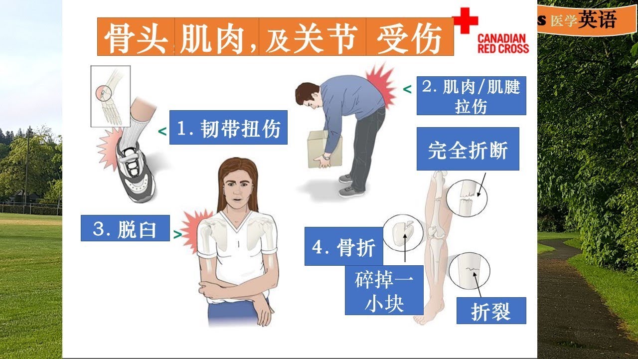 「骨折」的英文怎麼說？關於「骨折」的英文表達方式