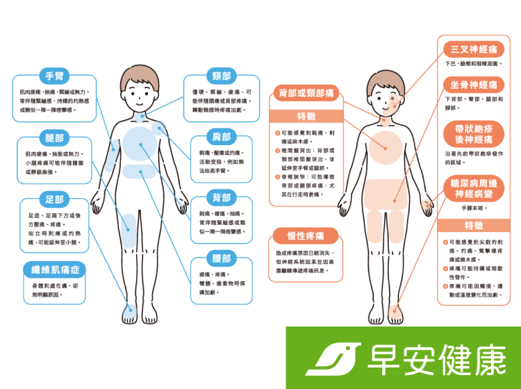 學會用英文來表示「肌肉酸痛」!另外也會介紹全身肌肉酸痛等的表現