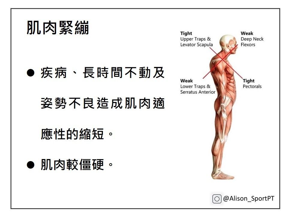 學會用英文來表示「肌肉酸痛」!另外也會介紹全身肌肉酸痛等的表現