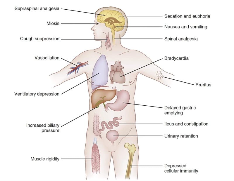 「疼痛」用英語怎麼表達？根據疼痛部位使用不同的說法！