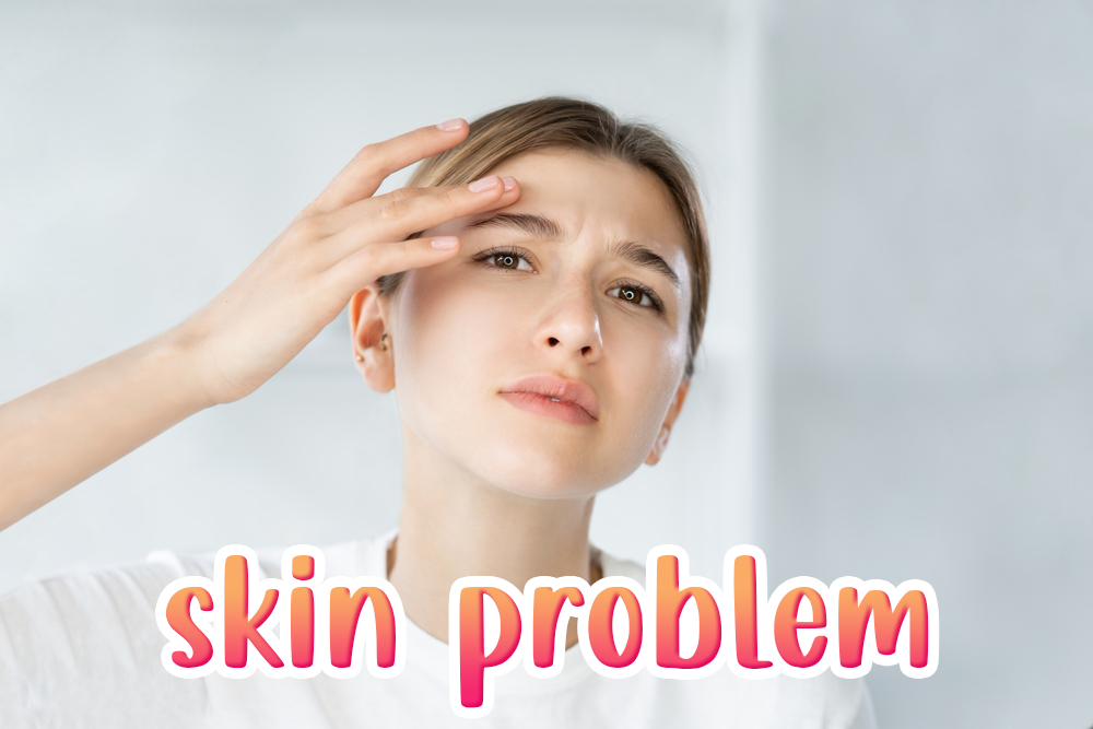 「肌膚問題」的英文怎麼說？各種皮膚問題一次講解