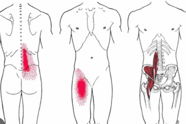 「疼痛」用英語怎麼表達？根據疼痛部位使用不同的說法！