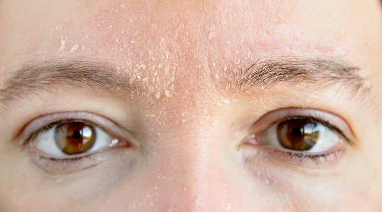 「肌膚問題」的英文怎麼說？各種皮膚問題一次講解