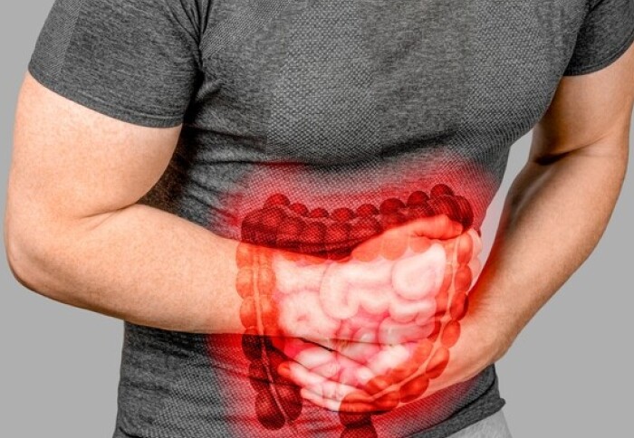 Major cause of inflammatory bowel disease found 英國科學傢找到炎癥性腸病的主要病因