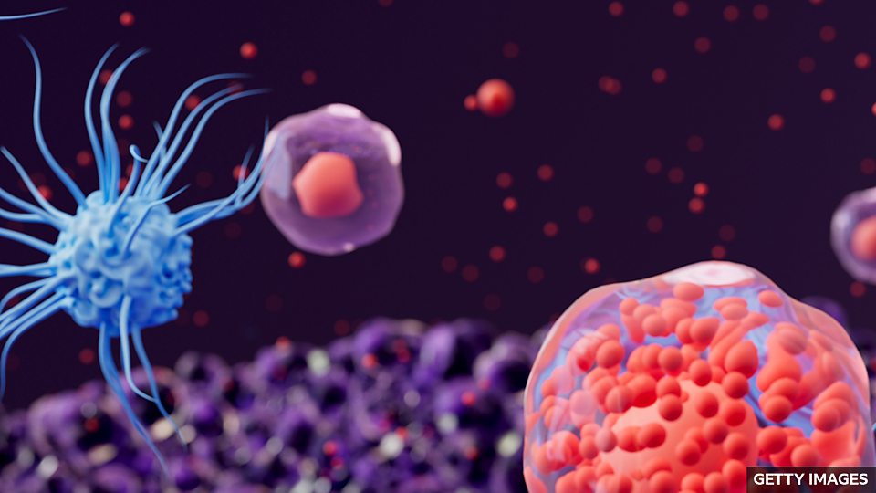 Major cause of inflammatory bowel disease found 英國科學傢找到炎癥性腸病的主要病因