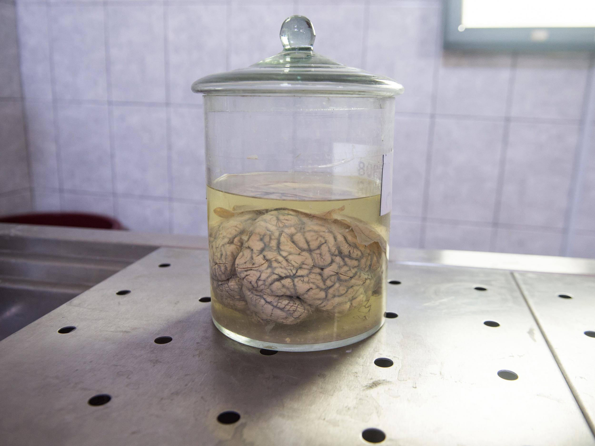 Reviving dead pig organs 豬死亡後臟器恢復生機