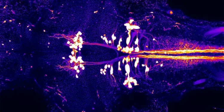 What happens to our brain when we sleep? 我們睡覺時大腦在做什麼?